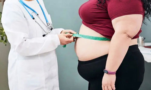 Obesity and Weight Management