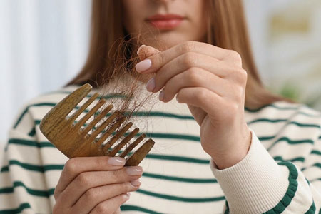Hair Loss
