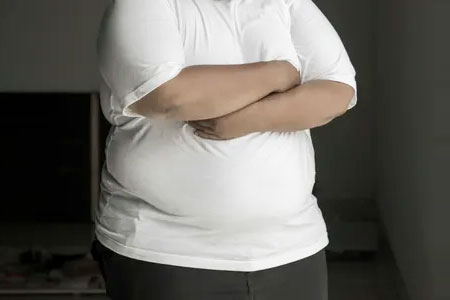 Obesity